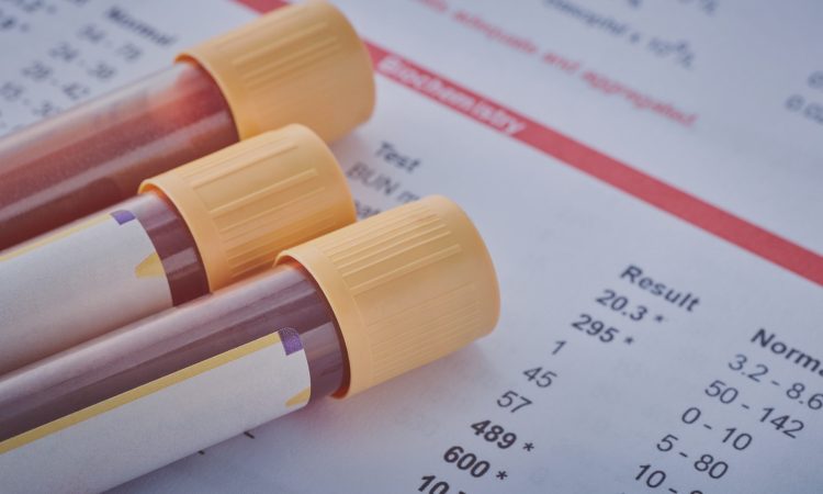 Banka Sparkasse z dobrodelnim kolesarjenjem zbrala 10.000 evrov za otroke z redkimi genskimi boleznimi